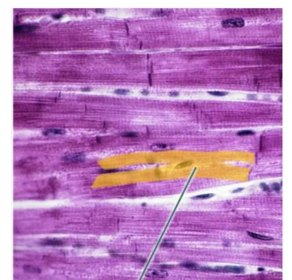 Identify the highlighted Structure