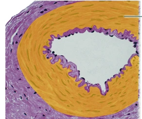 Identify the highlighted structure