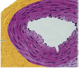 Identify the highlighted structure