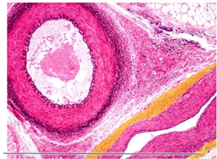 Identify the highlighted structure