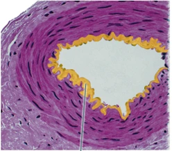 Identify the highlighted structure